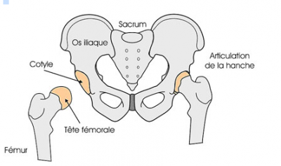 COXARTHROSE1