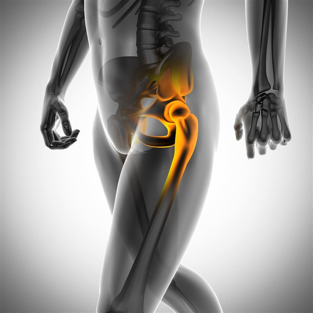 Arthrose de la hanche - Symptômes et traitement de l'arthrose