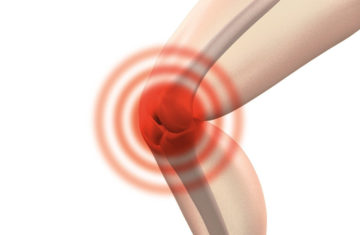 Revue du Podologue : Interventions chirurgicales dans l'arthrose du genou, par le Dr Casabianca