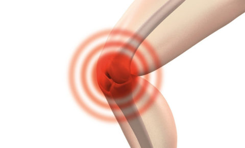 Revue du Podologue : Interventions chirurgicales dans l'arthrose du genou, par le Dr Casabianca